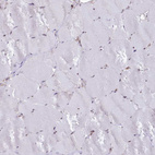 Immunohistochemical staining of human skeletal muscle shows no positivity in myocytes.