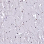 Immunohistochemical staining of human skeletal muscle shows no positivity in myocytes.