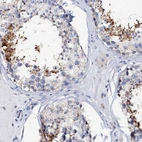 Immunohistochemical staining of human testis shows high expression.