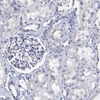 Anti-AKAP3 Antibody