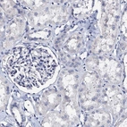 Immunohistochemical staining of human kidney shows low expression as expected.