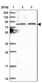 Lane 1: Marker [kDa] 250, 130, 95, 72, 55, 36, 28, 17, 10_br/_Lane 2: Human cell line RT-4_br/_Lane 3: Human cell line U-251MG sp