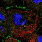 Immunofluorescent staining of human cell line A-431 shows localization to plasma membrane.
