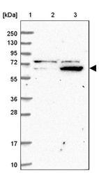 Lane 1: Marker [kDa] 250, 130, 95, 72, 55, 36, 28, 17, 10_br/_Lane 2: Human cell line RT-4_br/_Lane 3: Human cell line U-251MG sp