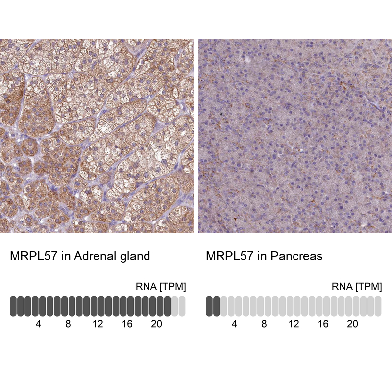 Anti-MRPL57 Antibody