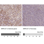 Anti-MRPL57 Antibody