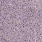 Immunohistochemical staining of human pancreas shows low expression as expected.