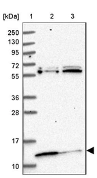 Lane 1: Marker [kDa] 250, 130, 95, 72, 55, 36, 28, 17, 10_br/_Lane 2: Human cell line RT-4_br/_Lane 3: Human cell line U-251MG sp