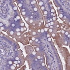 Immunohistochemical staining of human small intestine shows moderate cytoplasmic and membranous positivity in glandular cells.