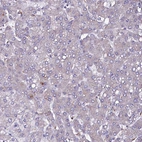 Immunohistochemical staining of human liver shows no cytoplasmic positivity in hepatocytes as expected.