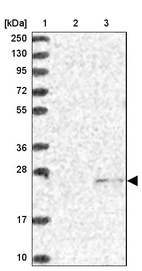 Lane 1: Marker [kDa] 250, 130, 95, 72, 55, 36, 28, 17, 10_br/_Lane 2: Human cell line RT-4_br/_Lane 3: Human cell line U-251MG sp