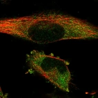 Immunofluorescent staining of human cell line U-251 MG shows positivity in cytoplasm.
