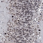 Anti-RUFY2 Antibody
