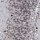 Anti-RUFY2 Antibody