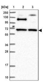 Lane 1: Marker [kDa] 250, 130, 95, 72, 55, 36, 28, 17, 10_br/_Lane 2: Human cell line RT-4_br/_Lane 3: Human cell line U-251MG sp