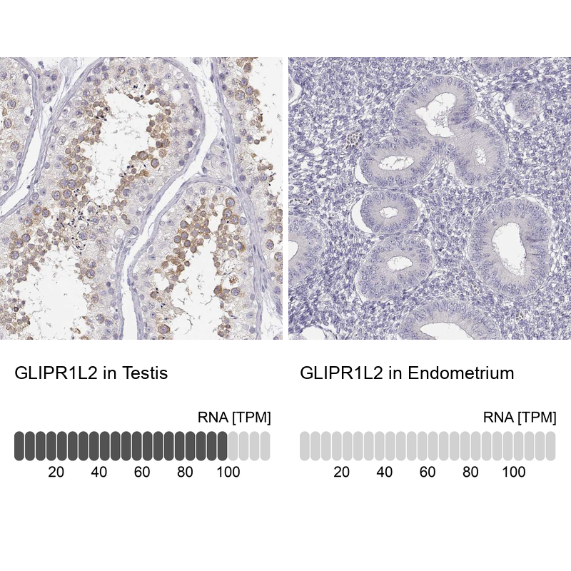 Anti-GLIPR1L2 Antibody