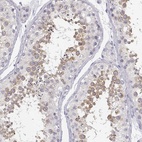 Immunohistochemical staining of human testis shows high expression.