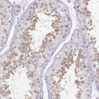 Anti-GLIPR1L2 Antibody