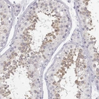 Immunohistochemical staining of human testis shows high expression.