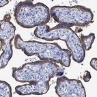 Immunohistochemical staining of human placenta shows strong membranous and cytoplasmic positivity in trophoblastic cells.