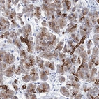 Immunohistochemical staining of human pancreas shows strong cytoplasmic and membranous positivity in exocrine glandular cells.