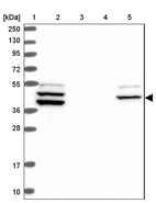 Lane 1: Marker [kDa] 250, 130, 95, 72, 55, 36, 28, 17, 10_br/_Lane 2: Human cell line RT-4_br/_Lane 3: Human cell line U-251MG sp_br/_Lane 4: Human plasma (IgG/HSA depleted)_br/_Lane 5: Human liver tissue