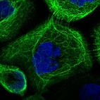 Immunofluorescent staining of human cell line A-431 shows localization to intermediate filaments.