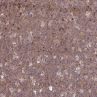 Immunohistochemical staining of human tonsil shows moderate to strong cytoplasmic positivity in germinal center cells.