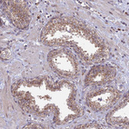 Immunohistochemical staining of human prostate shows moderate granular cytoplasmic positivity in glandular cells.