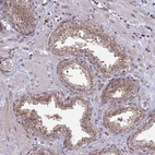 Immunohistochemical staining of human prostate shows moderate granular cytoplasmic positivity in glandular cells.