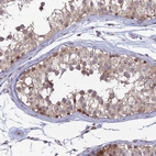 Immunohistochemical staining of human testis shows moderate to strong granular cytoplasmic positivity in cells in seminiferous ducts.