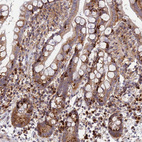 Immunohistochemical staining of human colon shows strong cytoplasmic positivity in lymphoid cells.
