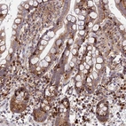 Immunohistochemical staining of human colon shows strong cytoplasmic positivity in lymphoid cells.