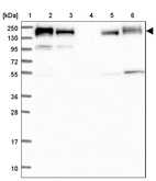 Lane 1: Marker [kDa] 250, 130, 95, 72, 55, 36, 28, 17, 10_br/_Lane 2: Human cell line RT-4_br/_Lane 3: Human cell line U-251MG sp_br/_Lane 4: Human plasma (IgG/HSA depleted)_br/_Lane 5: Human liver tissue_br/_Lane 6: Human tonsil tissue