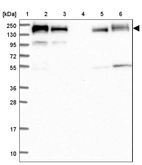 Lane 1: Marker [kDa] 250, 130, 95, 72, 55, 36, 28, 17, 10_br/_Lane 2: Human cell line RT-4_br/_Lane 3: Human cell line U-251MG sp_br/_Lane 4: Human plasma (IgG/HSA depleted)_br/_Lane 5: Human liver tissue_br/_Lane 6: Human tonsil tissue