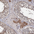 Anti-WWC3 Antibody