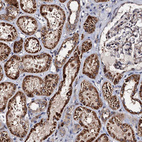 Immunohistochemical staining of human kidney shows strong granular cytoplasmic positivity in cells in tubules.