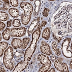 Immunohistochemical staining of human kidney shows strong granular cytoplasmic positivity in cells in tubules.