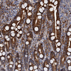 Immunohistochemical staining of human duodenum shows strong granular cytoplasmic positivity in glandular cells.