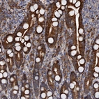 Immunohistochemical staining of human duodenum shows strong granular cytoplasmic positivity in glandular cells.