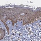 Immunohistochemical staining of human skin shows moderate granular cytoplasmic positivity in squamous epithelial cells.