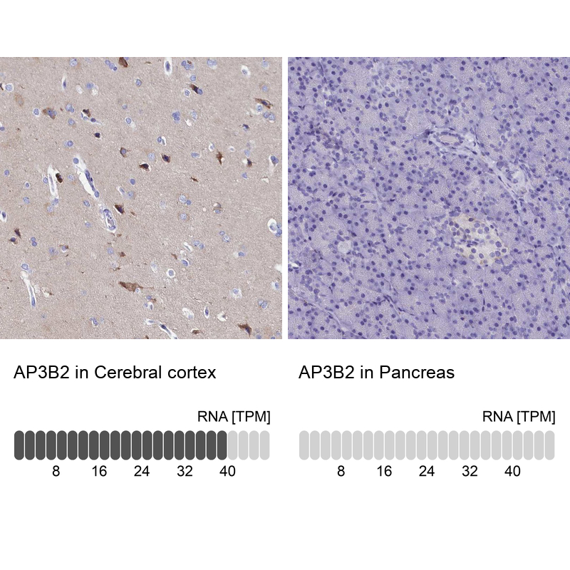 Anti-AP3B2 Antibody