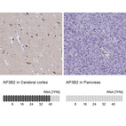 Anti-AP3B2 Antibody