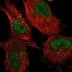 Immunofluorescent staining of human cell line U-251 MG shows localization to nucleoplasm & vesicles.