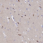 Immunohistochemical staining of human cerebral cortex shows high expression.
