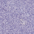 Anti-AP3B2 Antibody