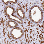 Immunohistochemical staining of human Prostate shows strong granular cytoplasmic positivity in glandular and smooth muscle cells.