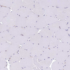 Immunohistochemical staining of human Skeletal muscle shows very weak cytoplasmic positivity in myocytes.