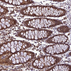 Immunohistochemical staining of human colon shows strong nuclear positivity in glandular cells.