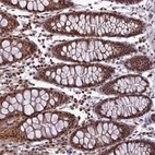 Immunohistochemical staining of human colon shows strong nuclear positivity in glandular cells.